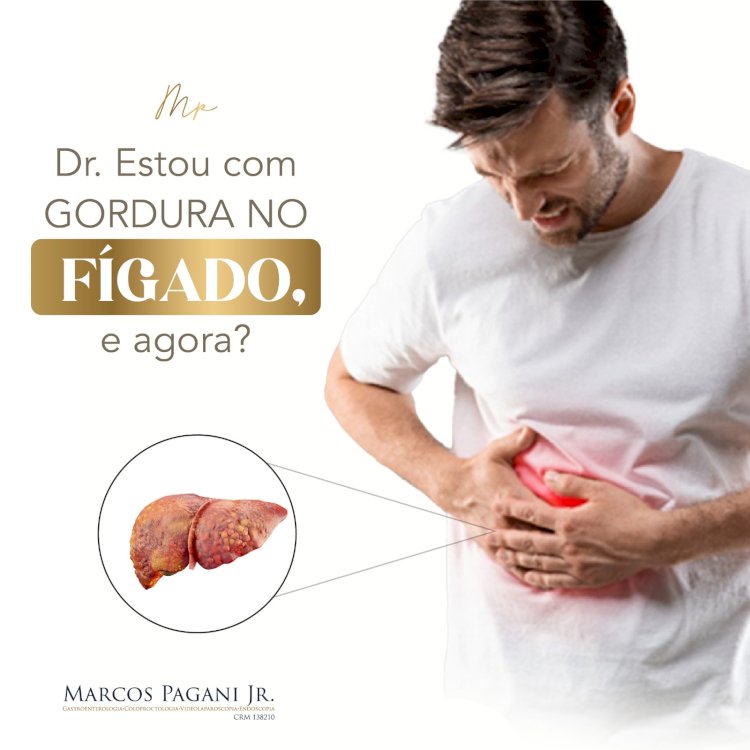 Dr. Estou Com Gordura No Fígado, e Agora?