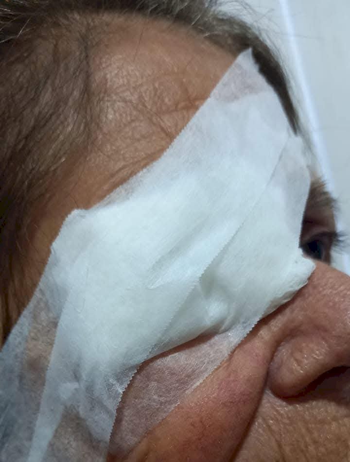 Atendente de saúde de Pompeia tem rosto atingido por querosene lançado por colega de trabalho e recebe atendimento médico de urgência