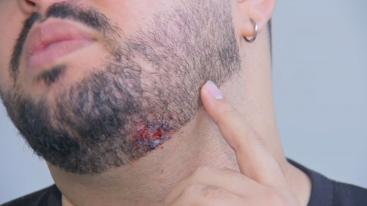'Senti um arranhão', diz vítima atingida por um dos disparos de PM que matou homem durante rodeio em Marília