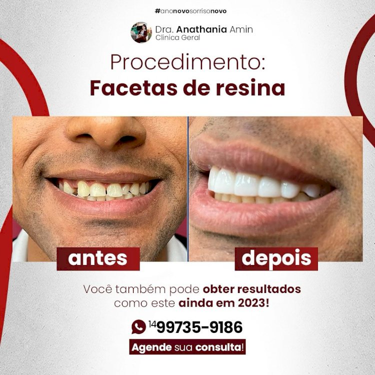 Dentista de Marília Conquista Pacientes Internacionais e Transforma Vidas Através de Sorrisos